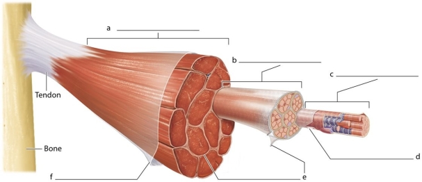   -Which labeled structure is the epimysium?