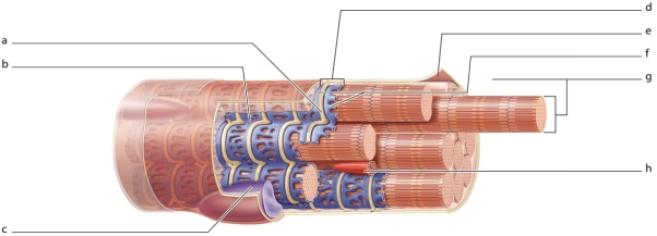   -Which labeled structure is the nucleus?