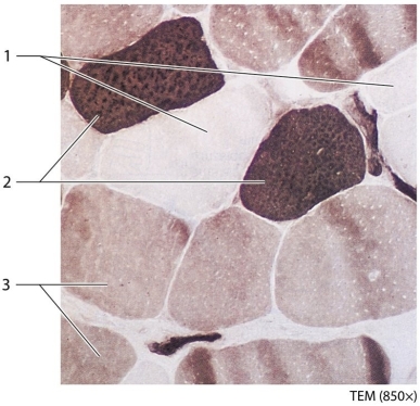 -Which muscle fiber type contains only a few mitochondria because it does not rely on aerobic respiration?