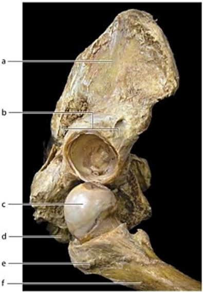   -Identify the structure labeled b.