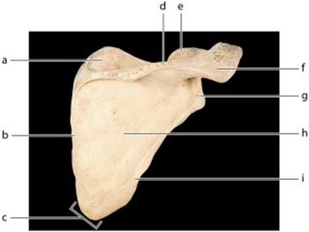   -Identify the bone feature labeled d.