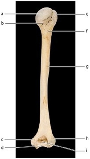 -Identify the bone feature labeled c.