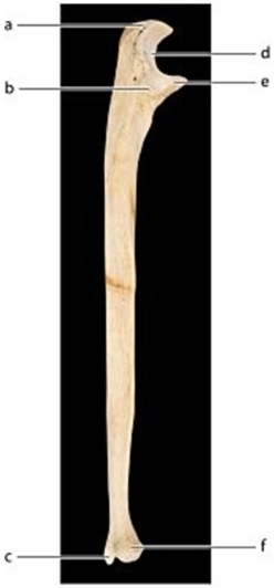 -Identify the bone feature labeled a.