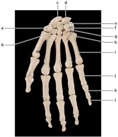 <strong> Identify the bone labeled j.</strong> A)Lunate B)Proximal phalanx C)Distal phalanx D)Metacarpal