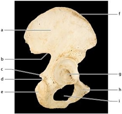   -Identify the bone feature labeled i.