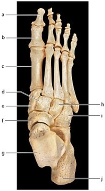   -Identify the bone labeled g.