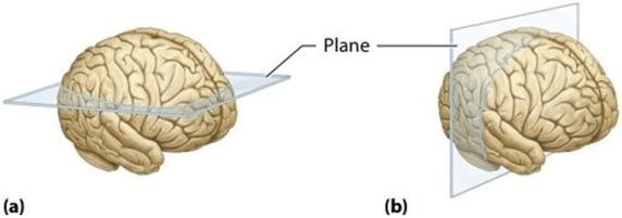 Which plane of section is being demonstrated in figure (a)?