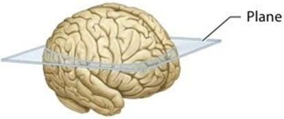 <strong> In this figure, the plane of section divides the brain into ________ parts.</strong> A)proximal and distal B)superior and inferior C)medial and lateral D)anterior and posterior