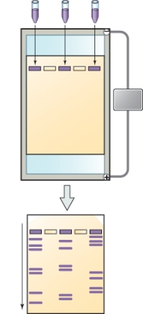 <strong>What is the name of the technique shown here? </strong> A) Karyotype B) Polymerase chain reaction C) Human genome project D) Restriction fragment length polymorphism
