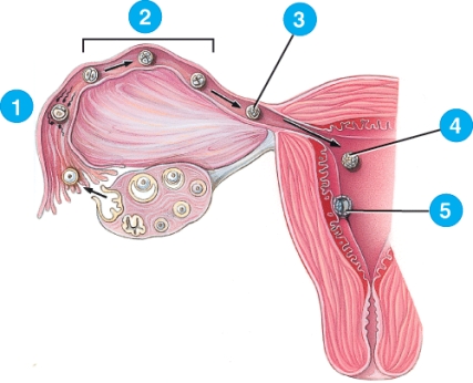 <strong>Which would be an accurate description of the step labeled 5? </strong> A) Fertilization B) Morula C) Blastocyst D) Implantation