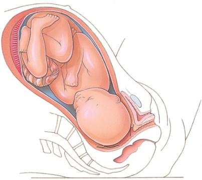<strong>Which stage of labor is depicted here? </strong> A) Dilation B) Expulsion C) Placental D) Birth