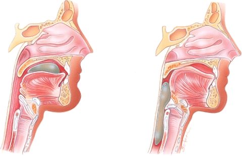 <strong>Which stage of swallowing is shown here? </strong> A) Voluntary stage B) Pharyngeal stage C) Esophageal stage D) Pyloric stage