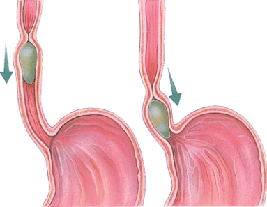 <strong>What is the name of the process pictured here? </strong> A) Digestion B) Absorption C) Peristalsis D) Maceration