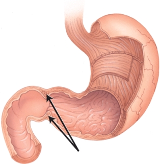 <strong>In the diagram, the arrow is pointing at the: </strong> A) rugae sphincter. B) duodenal sphincter. C) esophageal sphincter. D) pyloric sphincter.