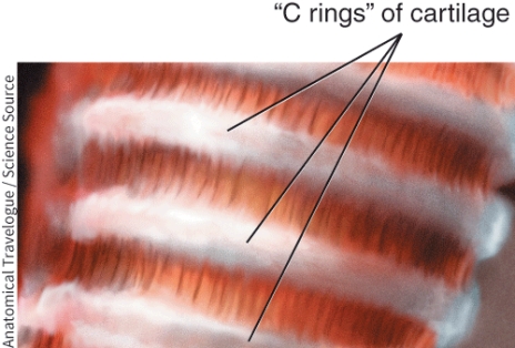 <strong>Identify this structure.  </strong> A) Pharynx B) Esophagus C) Bronchi D) Trachea <div style=padding-top: 35px> 