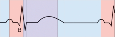 <strong>What is happening during the phase labeled B? </strong> A) Atrial depolarization B) Ventricular depolarization C) Ventricular repolarization D) AV valve closure