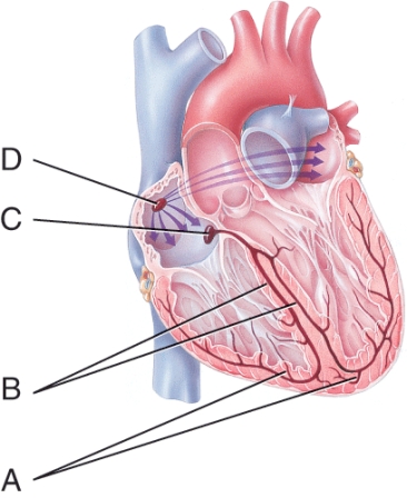 <strong>Where is the contraction impulse delayed? </strong> A) A B) B C) C D) D