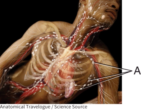 <strong>What is the name of the lymphatic structure A? </strong> A) thymus B) lymph node C) spleen D) tonsil