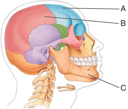 <strong>What bone is labeled C?  </strong> A) Maxilla B) Zygomatic bone C) Mandible D) Occipital bone <div style=padding-top: 35px> 