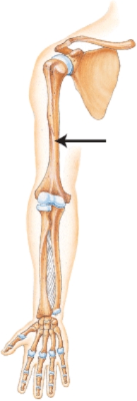 <strong>Which bone is indicated by the arrow?  </strong> A) Clavicle B) Scapula C) Humerus D) Ulna <div style=padding-top: 35px> 