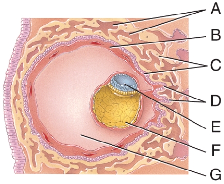<strong>What is line G pointing to? </strong> A) chorion B) chorionic villi C) sinusoid D) extraembryonic mesoderm E) None of these choices.
