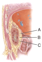 This structure is composed of dense irregular tissue that runs continuous with the ureter.   A) A B) B C) C D) A and B E) All of these answer choices are correct.<div style=padding-top: 35px> 