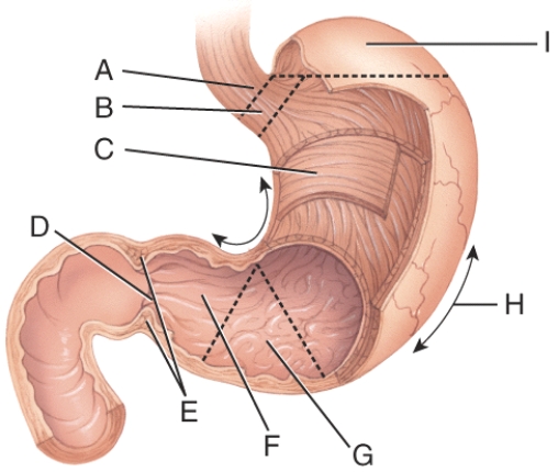 <strong>What is line I pointing to?  </strong> A) greater curvature B) lesser curvature C) body D) fundus E) cardia <div style=padding-top: 35px> 