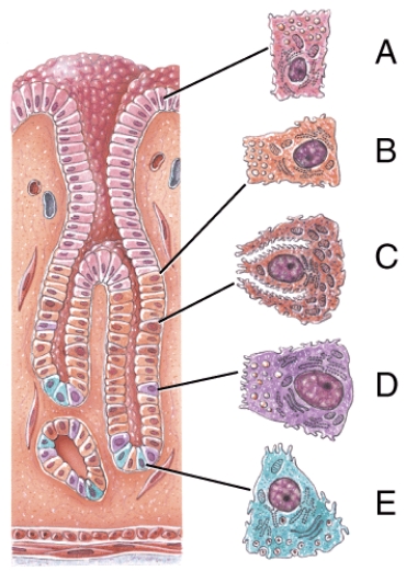 Which of the following cells secretes intrinsic factor?