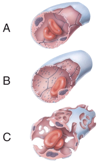 <strong>Which type of capillary wall has an incomplete or absent basement membrane? </strong> A) A B) B C) C D) A and B E) A, B, and C
