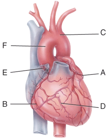 <strong>In the diagram, where is the posterior interventricular branch?  </strong> A) B B) D C) E D) F E) C <div style=padding-top: 35px> 