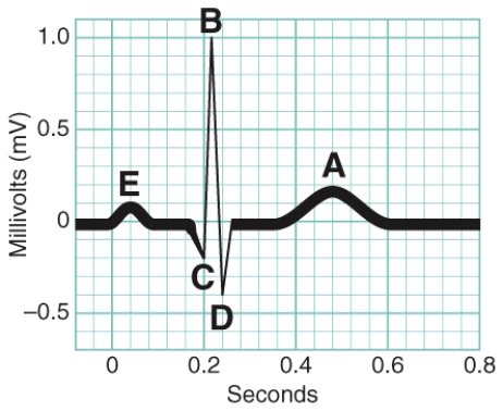 In the figure, which letter indicates the onset of ventricular repolarization?