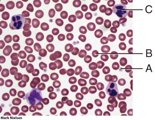 <strong>In the figure, which cell is a white blood cell? </strong> A) A B) B C) C D) both B and C E) All of these answer choices are correct.