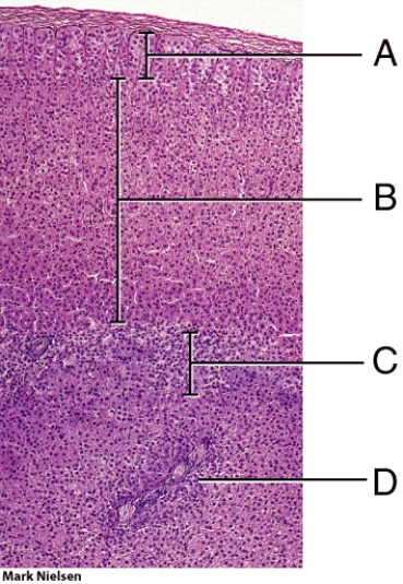 <strong>Which level secretes mainly aldosterone?  </strong> A) A B) B C) C D) D <div style=padding-top: 35px> 