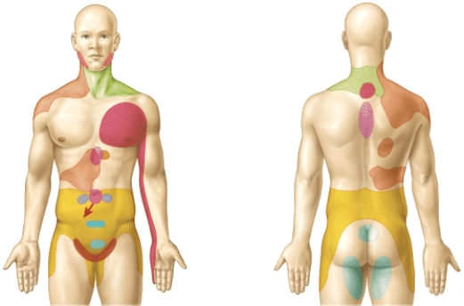 <strong>What does the figure represent?  </strong> A) dermatomes B) areas of referred pain C) regions of nociceptors D) areas supplied by the primary somatosensory area E) areas supplied by the primary motor region <div style=padding-top: 35px> 