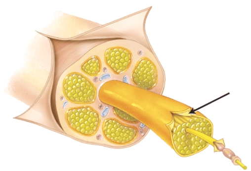 <strong>The connective tissue sheath around a group of neuronal fibers (a fascicle) is called the </strong> A) endoneurium. B) perineurium. C) epineurium. D) fasciculus.