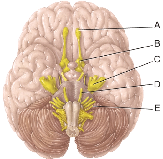 <strong>In the figure, the Vagus cranial nerve would be represented by: </strong> A) A B) B C) C D) D E) E