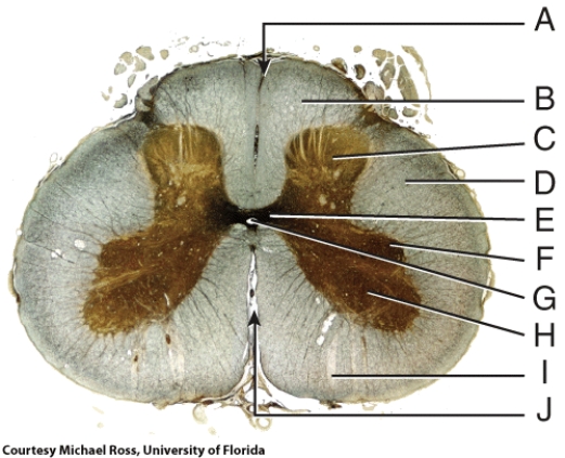 <strong>In the figure, where is the anterior white column? </strong> A) B B) C C) H D) I E) J
