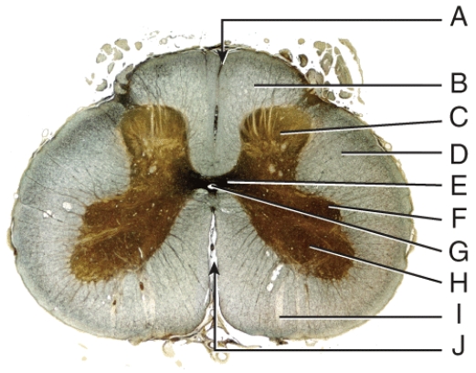 <strong>The structure containing cell bodies of somatic motor neurons that provide nerve impulses for skeletal muscle contractions would be: </strong> A) B B) C C) D D) H E) I