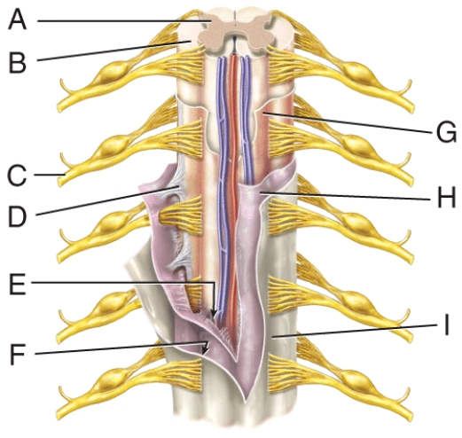 <strong>In the figure, where is the denticulate ligament? </strong> A) C B) D C) F D) H E) I