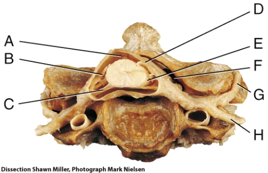 <strong>Where is the epidural space? </strong> A) A B) D C) E D) F E) G