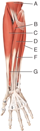 Where is the flexor carpi radialis?  