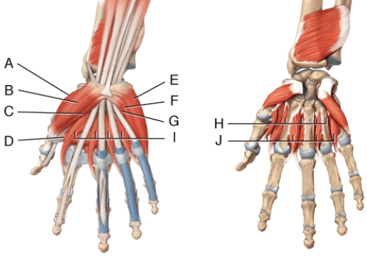 Where is the flexor pollicis brevis?  