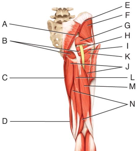 Where is the piriformis?  
