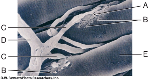 <strong>In the diagram, which parts make up the neuromuscular junction? </strong> A) A, B, E B) C, A, B, E C) B, E D) A, B, C, D, E E) C, E