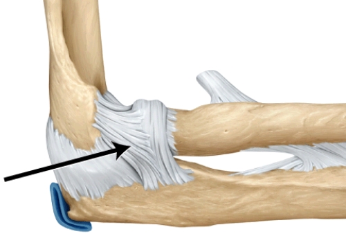<strong>What is this structure? </strong> A) annular ligament of the radius B) coracohumeral ligament C) radial collateral ligament D) oblique popliteal ligament E) ulnar collateral ligament