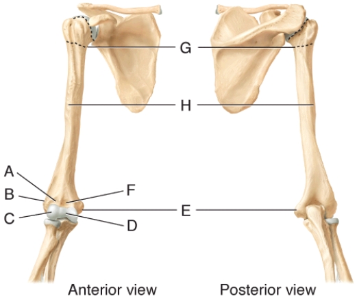 <strong>The coronoid fossa is labeled ___ in the diagram. </strong> A) B B) C C) A D) F E) D