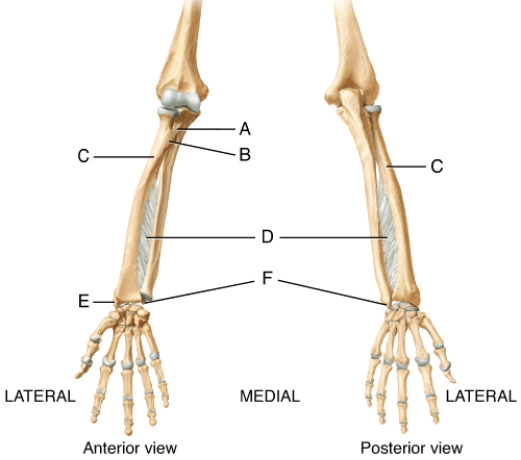 <strong>Identify the attachment sites for tendons of the deep skeletal muscles of the forearm. </strong> A) A B) B C) D D) E E) F