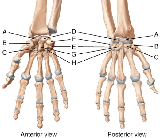 In the diagram of the hand, where is the pisiform bone?  