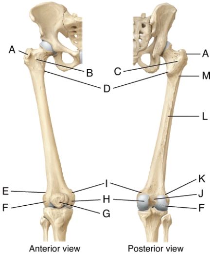 In the diagram of the femur, where is the intertrochanteric line?  