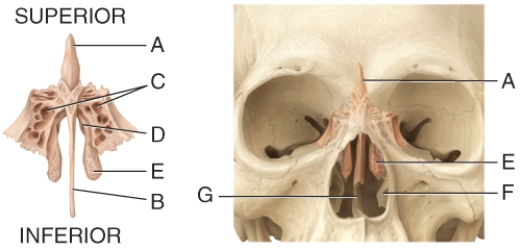 In the diagram, this region of the bone is covered by membranes that contain the receptors for the sense of smell.